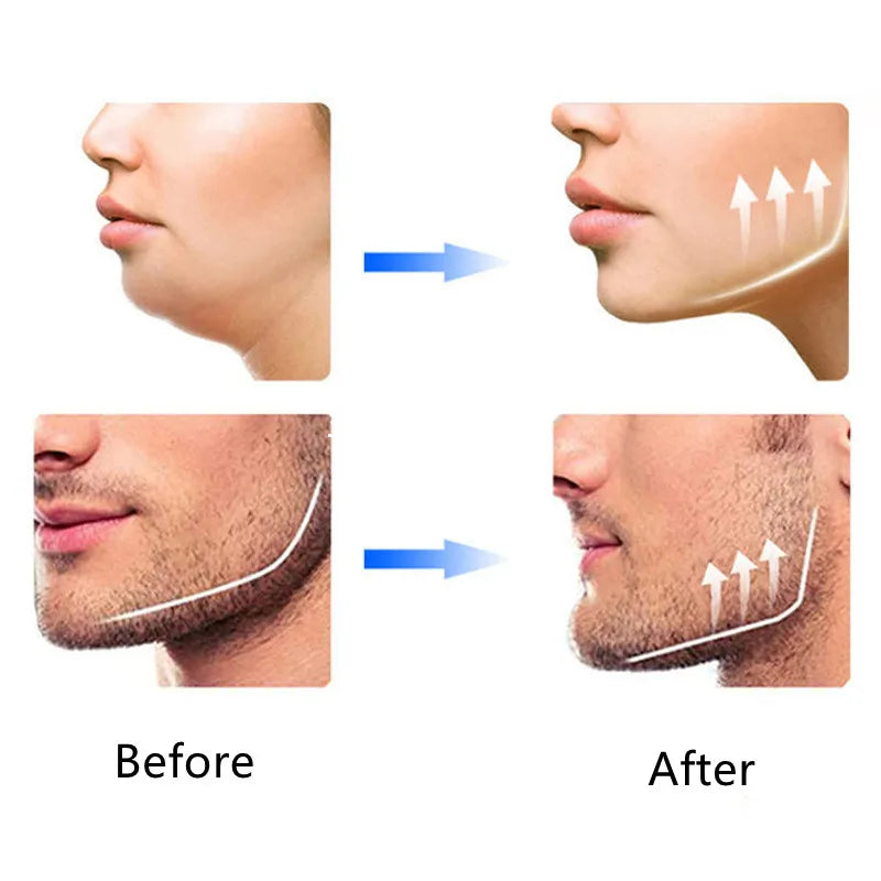 Exercitador de Mandíbula e Maxilar MaxiPlus® pague 1 e leve 3✅ - Últimas Unidades!!